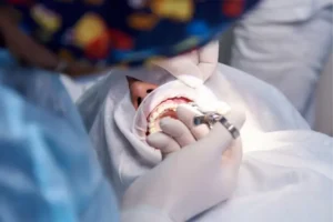 Crown Lengthening Surgery: Steps, Healing, and What to Expect